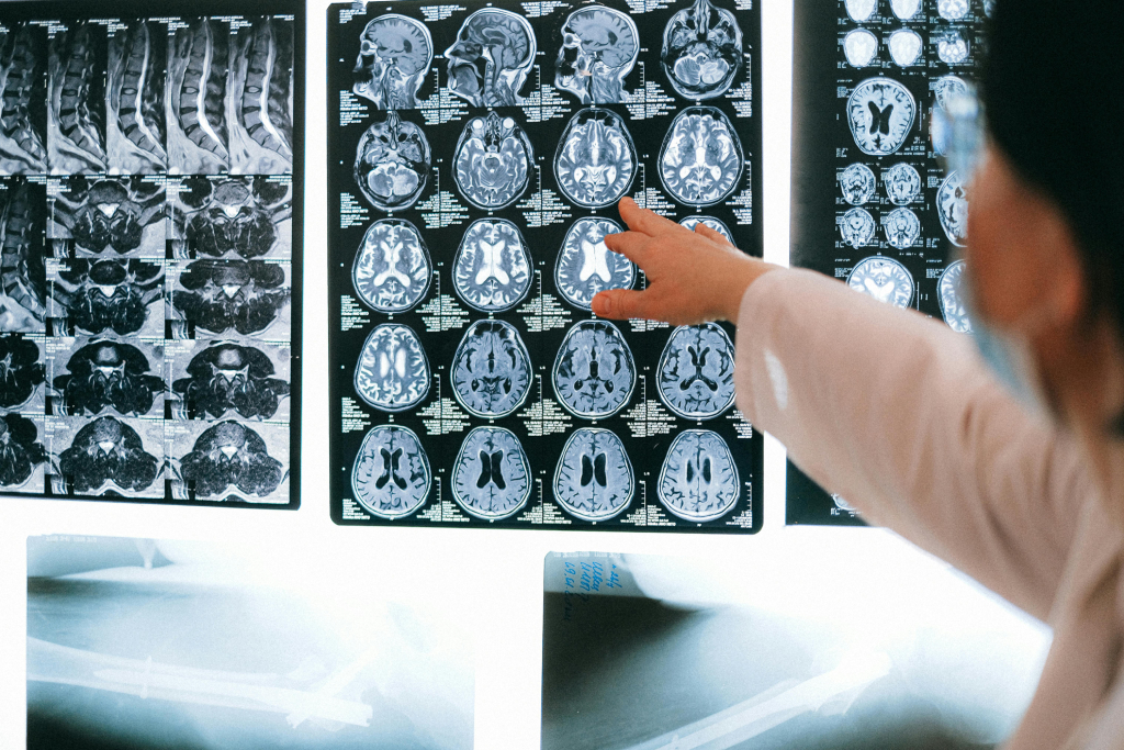 radiology transcription services, Medico-Legal Transcription, Medical Transcription Company, Medical Transcription Service, Business Transcription, Market Research Transcription